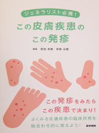 ジェネラリスト必携！この皮膚疾患のこの発疹