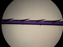 切らないフェイスリフト　－What is  N-COG ?－