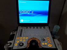 高周波プローブ　エコー機器を導入