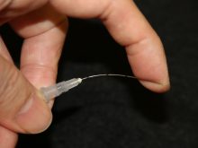 鈍針カニューレを用いたヒアルロン酸注入