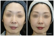 ソフウェーブ　モニターさま４