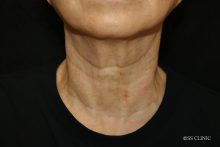 ソフウェーブ　モニターさま３