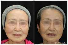 ソフウェーブ　モニターさま５