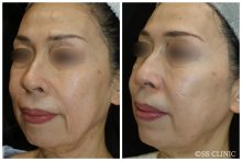 ソフウェーブ　モニターさま6