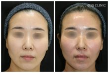 ソフウェーブ　モニターさま7